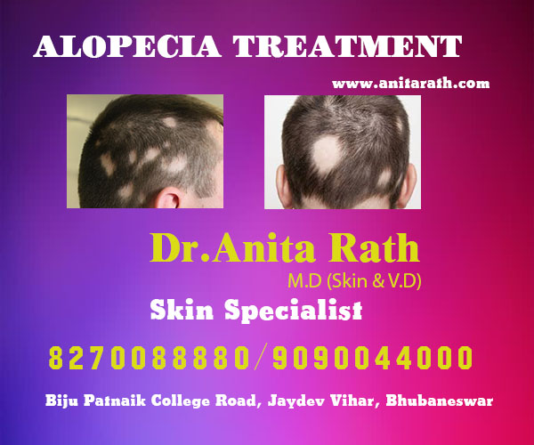 best hair treatment clinic in bhubaneswar near ayush hospital